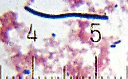 "Lactobacillus Bulgaricus" from a sample of yogurt. Numbered ticks are 11 μm apart.