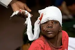 A black child stares through one eye. A hand attends to a bandage which covers his head and that has blood seeping through it. The boy's face is cut and injured. He wears a T-shirt that is sodden and dirty.