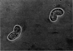 Ceratomyxa shasta, another myxosporean parasite, infects salmonid fish on the Pacific coast of North America.