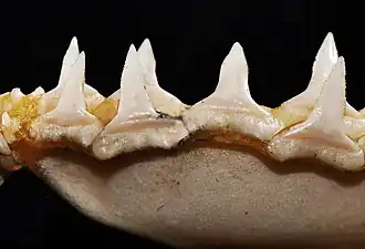 Lower teeth