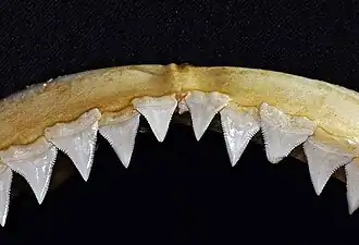Upper teeth