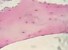 Bone, cell nuclei (blue-purple), bone matrix (pink)