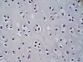 Magnified cross-section of the cartilage of the trachea