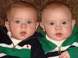 Two identically dressed babies looking at the camera.
