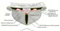 Coronal section of lateral and third ventricles