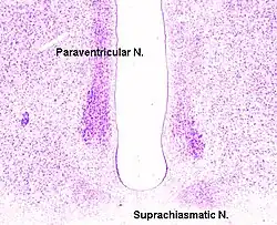Cross-section of the monkey hypothalamus displays two of the major hypothalamic nuclei on either side of the fluid-filled third ventricle.