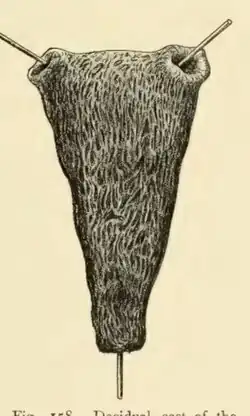 Anatomical drawing of a decidual cast