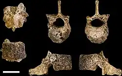 Views of an eleventh thoracic vertebra