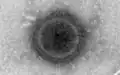 Nipah virus (Paramyxoviridae)