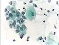 Normal endocervical cells should be present into the slide, as a proof of a good quality sampling.
