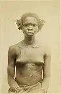Zande woman, late 1870s, with skin scarifications
