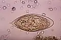 Schistosoma haematobium