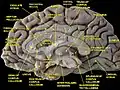 Median sagittal section of the human brain.
