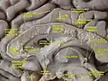 Medial sagittal section of the human brain.