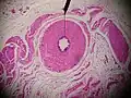 Microscopic cross section.