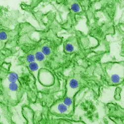Electron micrograph of "Zika virus". Virus particles (colored purple) are 40 nm in diameter, with an outer envelope and a dense inner core.
